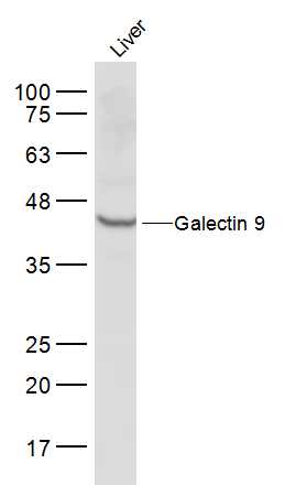 Mouse liver lysates probed with Galectin 9 Polyclonal Antibody, Unconjugated (bs-1699R) at 1:500 dilution and 4˚C overnight incubation. Followed by conjugated secondary antibody incubation at 1:10000 for 60 min at 37˚C.