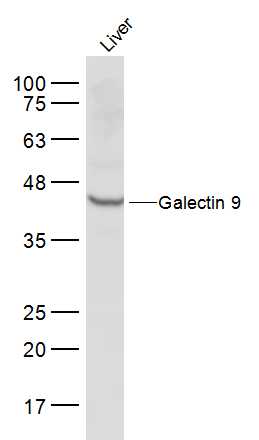 Mouse liver lysates probed with Galectin 9 Polyclonal Antibody, Unconjugated (bs-1699R) at 1:500 dilution and 4˚C overnight incubation. Followed by conjugated secondary antibody incubation at 1:10000 for 60 min at 37˚C. Mouse liver lysates probed with Galectin 9 Polyclonal Antibody, Unconjugated (bs-1699R) at 1:500 dilution and 4˚C overnight incubation. Followed by conjugated secondary antibody incubation at 1:10000 for 60 min at 37˚C.