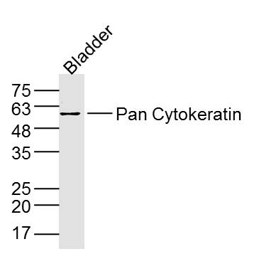 Mouse Bladder lysates probed with Pan Cytokeratin Polyclonal Antibody, Unconjugated (bs-1712R) at 1:300 dilution and 4˚C overnight incubation. Followed by conjugated secondary antibody incubation at 1:10000 for 60 min at 37˚C.