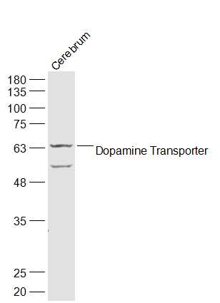 Rat Cerebrum lysates probed with Dopamine Transporter Polyclonal Antibody, Unconjugated (bs-1714R) at 1:500 dilution and 4˚C overnight incubation. Followed by conjugated secondary antibody incubation at 1:10000 for 60 min at 37˚C.