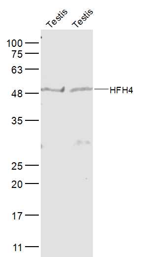 Lane 1: Mouse Testis lysates; Lane 2: Rat Testis lysates probed with HFH4 Polyclonal Antibody, Unconjugated (bs-1775R) at 1:1000 dilution and 4˚C overnight incubation. Followed by conjugated secondary antibody incubation at 1:10000 for 60 min at 37˚C. Lane 1: Mouse Testis lysates; Lane 2: Rat Testis lysates probed with HFH4 Polyclonal Antibody, Unconjugated (bs-1775R) at 1:1000 dilution and 4˚C overnight incubation. Followed by conjugated secondary antibody incubation at 1:10000 for 60 min at 37˚C.