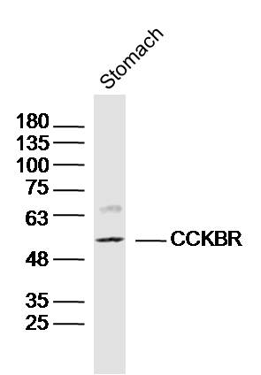 Mouse Stomach lysates probed with CCKBR Polyclonal Antibody, Unconjugated (bs-1777R) at 1:300 dilution and 4˚C overnight incubation. Followed by conjugated secondary antibody incubation at 1:10000 for 60 min at 37˚C.