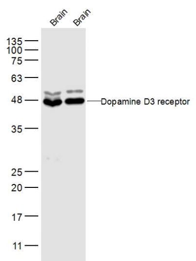 Lane 1: Mouse Brain lysates; Lane 2: Rat Brain lysates probed with Dopamine D3 receptor Polyclonal Antibody, Unconjugated (bs-1743R) at 1:500 dilution and 4˚C overnight incubation. Followed by conjugated secondary antibody incubation at 1:10000 for 60 min at 37˚C. Lane 1: Mouse Brain lysates; Lane 2: Rat Brain lysates probed with Dopamine D3 receptor Polyclonal Antibody, Unconjugated (bs-1743R) at 1:500 dilution and 4˚C overnight incubation. Followed by conjugated secondary antibody incubation at 1:10000 for 60 min at 37˚C.