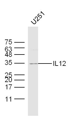 U251 lysates probed with IL12 Polyclonal Antibody, Unconjugated (bs-1789R) at 1:300 dilution and 4˚C overnight incubation. Followed by conjugated secondary antibody incubation at 1:10000 for 60 min at 37˚C.
