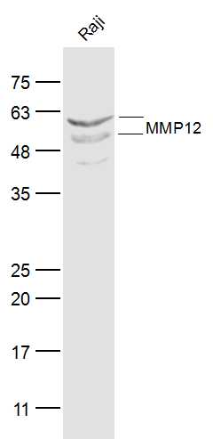 Human Raji lysates probed with MMP12 Polyclonal Antibody, Unconjugated (bs-1854R) at 1:300 dilution and 4˚C overnight incubation. Followed by conjugated secondary antibody incubation at 1:10000 for 60 min at 37˚C. Human Raji lysates probed with MMP12 Polyclonal Antibody, Unconjugated (bs-1854R) at 1:300 dilution and 4˚C overnight incubation. Followed by conjugated secondary antibody incubation at 1:10000 for 60 min at 37˚C.