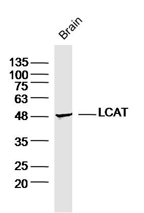 Mouse brain lysates probed with LCAT Polyclonal Antibody, Unconjugated (bs-1972R) at 1:300 dilution and 4˚C overnight incubation. Followed by conjugated secondary antibody incubation at 1:10000 for 60 min at 37˚C.