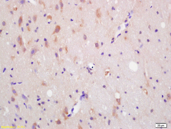 Formalin-fixed and paraffin embedded rat brain labeled with Anti-CXCR7\/RDC1 Polyclonal Antibody, Unconjugated (bs-4897R) at 1:200 followed by conjugation to the secondary antibody and DAB staining.