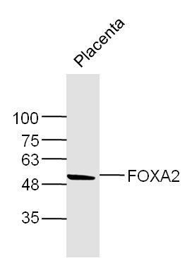 Mouse Placenta lysates probed with FOXA2 Polyclonal Antibody, Unconjugated (bs-2358R) at 1:300 dilution and 4˚C overnight incubation. Followed by conjugated secondary antibody incubation at 1:10000 for 60 min at 37˚C.