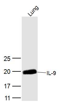 Mouse lung lysates probed with IL-9 Polyclonal Antibody, Unconjugated (bs-2428R) at 1:300 dilution and 4˚C overnight incubation. Followed by conjugated secondary antibody incubation at 1:10000 for 60 min at 37˚C.