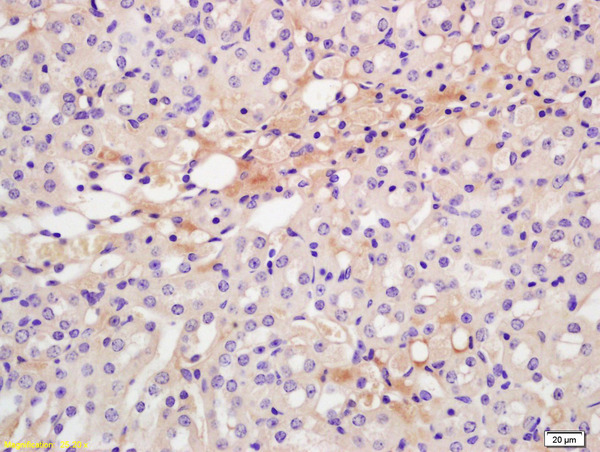 Formalin-fixed and paraffin embedded rat kidney labeled with Anti-CXCR7\/RDC1 Polyclonal Antibody, Unconjugated (bs-4897R) at 1:200 followed by conjugation to the secondary antibody and DAB staining.