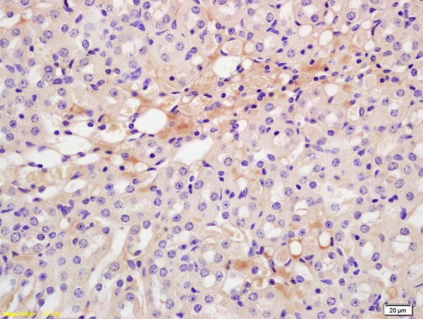 Formalin-fixed and paraffin embedded rat kidney labeled with Anti-CXCR7/RDC1 Polyclonal Antibody, Unconjugated (bs-4897R) at 1:200 followed by conjugation to the secondary antibody and DAB staining.