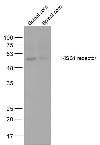 Lane 1: Mouse Spinal cord lysates; Lane 2: Rat Spinal cord lysates probed with KiSS1 receptor Polyclonal Antibody, Unconjugated (bs-2501R) at 1:2000 dilution and 4˚C overnight incubation. Followed by conjugated secondary antibody incubation at 1:10000 for 60 min at 37˚C.