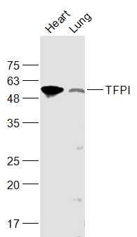 Lane 1: Mouse Heart lysates; Lane 2: Rat Lung lysates probed with TFPI Polyclonal Antibody, Unconjugated (bs-2535R) at 1:1000 dilution and 4˚C overnight incubation. Followed by conjugated secondary antibody incubation at 1:10000 for 60 min at 37˚C.