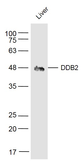 Mouse Liver lysates probed with DDB2 Polyclonal Antibody, Unconjugated (bs-2599R) at 1:500 dilution and 4˚C overnight incubation. Followed by conjugated secondary antibody incubation at 1:10000 for 60 min at 37˚C.