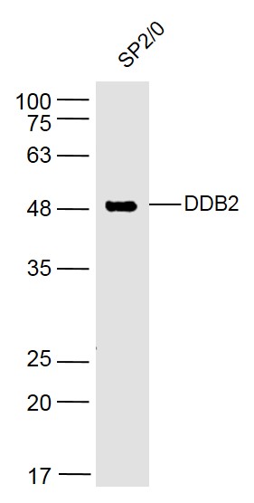 SP2/0 lysates probed with DDB2 Polyclonal Antibody, Unconjugated (bs-2599R) at 1:500 dilution and 4˚C overnight incubation. Followed by conjugated secondary antibody incubation at 1:10000 for 60 min at 37˚C.