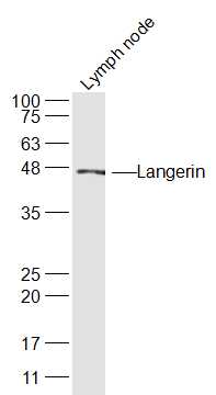 Mouse Lymph node lysates probed with Langerin Polyclonal Antibody, Unconjugated (bs-2650R) at 1:300 dilution and 4˚C overnight incubation. Followed by conjugated secondary antibody incubation at 1:10000 for 60 min at 37˚C.