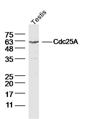 Mouse Testis lysates probed with Cdc25A Polyclonal Antibody, Unconjugated (bs-2758R) at 1:300 dilution and 4˚C overnight incubation. Followed by conjugated secondary antibody incubation at 1:10000 for 60 min at 37˚C.