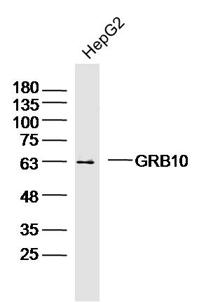 HepG2 lysates probed with GRB10 Polyclonal Antibody, Unconjugated (bs-2769R) at 1:300 dilution and 4˚C overnight incubation. Followed by conjugated secondary antibody incubation at 1:10000 for 60 min at 37˚C.