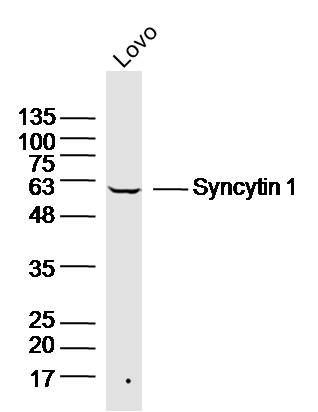 LOVO lysates probed with Syncytin 1 Polyclonal Antibody, Unconjugated (bs-2962R) at 1:300 dilution and 4˚C overnight incubation. Followed by conjugated secondary antibody incubation at 1:10000 for 60 min at 37˚C.