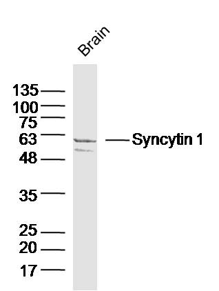 Mouse Brain lysates probed with Syncytin 1 Polyclonal Antibody, Unconjugated (bs-2962R) at 1:300 dilution and 4˚C overnight incubation. Followed by conjugated secondary antibody incubation at 1:10000 for 60 min at 37˚C.