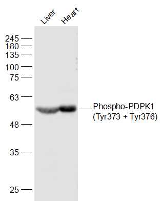 Lane 1: Mouse Liver lysates; Lane 2: Mouse Heart lysates probed with Phospho-PDPK1(Tyr373 + Tyr376) Polyclonal Antibody, Unconjugated (bs-3017R) at 1:500 dilution and 4˚C overnight incubation. Followed by conjugated secondary antibody incubation at 1:10000 for 60 min at 37˚C.
