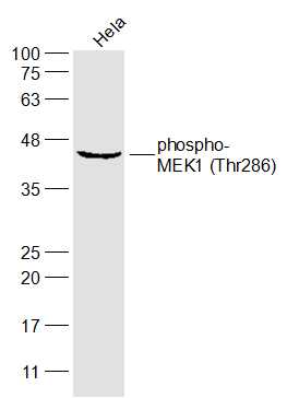 Hela lysates probed with MEK1 (Thr286) Polyclonal Antibody, Unconjugated (bs-3269R) at 1:300 dilution and 4˚C overnight incubation. Followed by conjugated secondary antibody incubation at 1:10000 for 60 min at 37˚C.