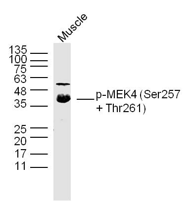 Mouse Muscle lysates probed with p-MEK4(Ser257 + Thr261) Polyclonal Antibody, Unconjugated (bs-3394R) at 1:300 dilution and 4˚C overnight incubation. Followed by conjugated secondary antibody incubation at 1:10000 for 60 min at 37˚C.