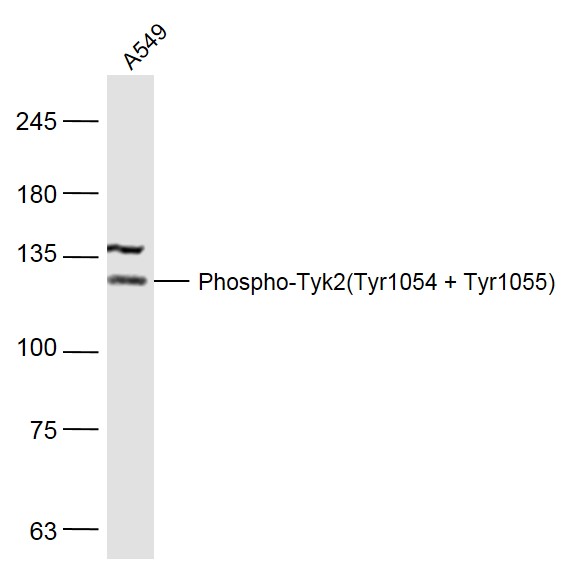 A549 lysates probed with Phospho-Tyk2(Tyr1054 + Tyr1055) Polyclonal Antibody, Unconjugated (bs-3437R) at 1:500 dilution and 4˚C overnight incubation. Followed by conjugated secondary antibody incubation at 1:10000 for 60 min at 37˚C.