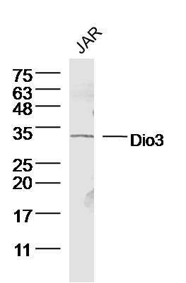 Human JAR lysates probed with Dio3 Polyclonal Antibody, Unconjugated (bs-3902R) at 1:300 dilution and 4˚C overnight incubation. Followed by conjugated secondary antibody incubation at 1:10000 for 60 min at 37˚C.