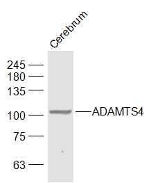 Mouse Cerebrum lysates probed with ADAMTS4 Polyclonal Antibody, Unconjugated (bs-4191R) at 1:1000 dilution and 4˚C overnight incubation. Followed by conjugated secondary antibody incubation at 1:10000 for 60 min at 37˚C.