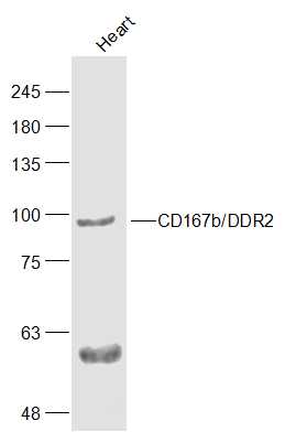 Mouse Heart lysates probed with CD167b'DDR2 Polyclonal Antibody, Unconjugated (bs-4194R) at 1:500 dilution and 4˚C overnight incubation. Followed by conjugated secondary antibody incubation at 1:10000 for 60 min at 37˚C.