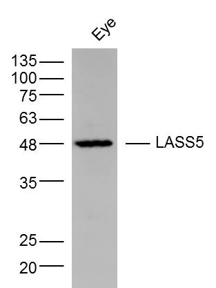 Mouse Eye lysates probed with LASS5 Polyclonal Antibody, Unconjugated (bs-5082R) at 1:300 dilution and 4˚C overnight incubation. Followed by conjugated secondary antibody incubation at 1:10000 for 60 min at 37˚C.