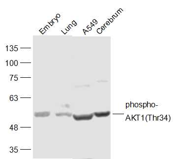Lane 1: Mouse Embryo lysates; Lane 2: Mouse Lung lysates; Lane 3: A549 lysates; Lane 4: Mouse Cerebrum lysates probed with AKT1(Thr34) Polyclonal Antibody, Unconjugated (bs-5194R) at 1:300 dilution and 4˚C overnight incubation. Followed by conjugated secondary antibody incubation at 1:10000 for 60 min at 37˚C.