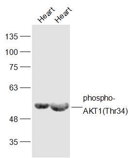 Lane 1: Mouse Heart lysates; Lane 2: Rat Heart lysates probed with phospho-AKT1(Thr34) Polyclonal Antibody, Unconjugated (bs-5194R) at 1:300 dilution and 4˚C overnight incubation. Followed by conjugated secondary antibody incubation at 1:10000 for 60 min at 37˚C. 