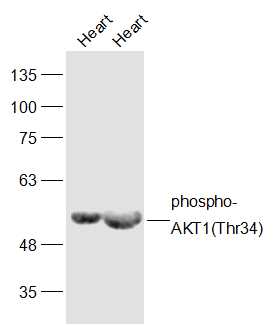 Lane 1: Mouse Heart lysates; Lane 2: Rat Heart lysates probed with phospho-AKT1(Thr34) Polyclonal Antibody, Unconjugated (bs-5194R) at 1:300 dilution and 4˚C overnight incubation. Followed by conjugated secondary antibody incubation at 1:10000 for 60 min at 37˚C.