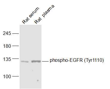 Lane 1: Rat serum lysates; Lane 2: Rat plasma lysates probed with phospho-EGFR (Tyr1110) Polyclonal Antibody, Unconjugated (bs-5316R) at 1:1000 dilution and 4˚C overnight incubation. Followed by conjugated secondary antibody incubation at 1:10000 for 60 min at 37˚C.