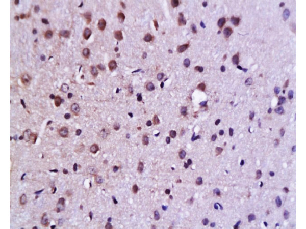 Formalin-fixed and paraffin embedded rat brain tissue labeled Anti-C-Jun Polyclonal Antibody (bs-0670R), Unconjugated at 1:200, followed by conjugation to the secondary antibody and DAB staining