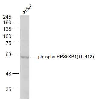 Jurkat lysates probed with RPS6KB1(Thr412) Polyclonal Antibody, Unconjugated (bs-5669R) at 1:300 dilution and 4˚C overnight incubation. Followed by conjugated secondary antibody incubation at 1:10000 for 60 min at 37˚C.