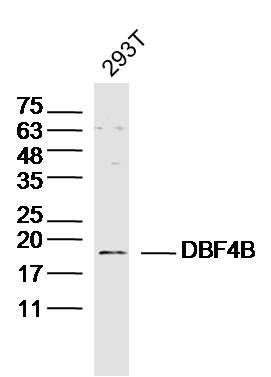 293T lysates probed with DBF4B Polyclonal Antibody, Unconjugated (bs-5748R) at 1:300 dilution and 4˚C overnight incubation. Followed by conjugated secondary antibody incubation at 1:10000 for 60 min at 37˚C.