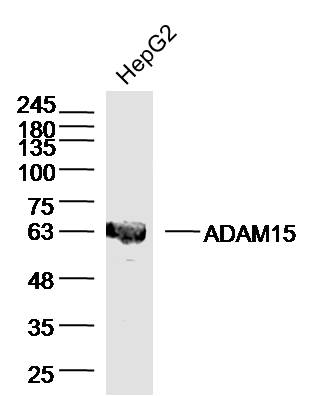HepG2 lysates probed with ADAM15 Polyclonal Antibody, Unconjugated (bs-5848R) at 1:300 dilution and 4˚C overnight incubation. Followed by conjugated secondary antibody incubation at 1:10000 for 60 min at 37˚C.
