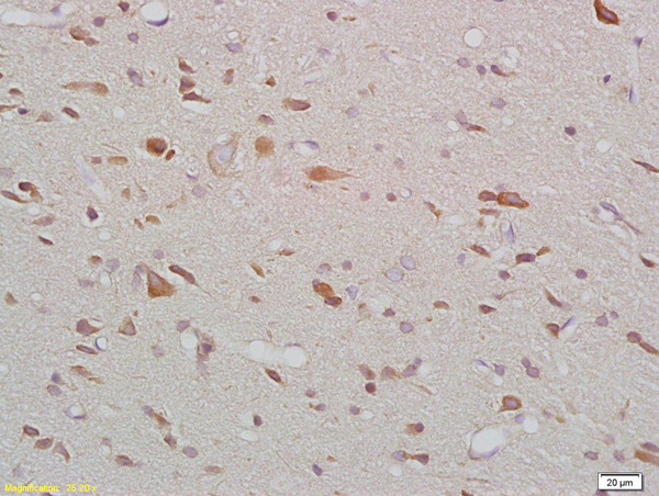Formalin-fixed and paraffin embedded rat brain labeled with Anti-MTNR1B Polyclonal Antibody, Unconjugated (bs-0963R) at 1:200 followed by conjugation to the secondary antibody and DAB staining.
