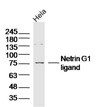 Hela lysates probed with Netrin G1 ligand Polyclonal Antibody, Unconjugated (bs-6710R) at 1:300 dilution and 4˚C overnight incubation. Followed by conjugated secondary antibody incubation at 1:10000 for 60 min at 37˚C.