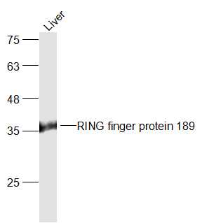 Mouse Liver lysates probed with RING finger protein 189 Polyclonal Antibody, Unconjugated (bs-6872R) at 1:300 dilution and 4˚C overnight incubation. Followed by conjugated secondary antibody incubation at 1:10000 for 60 min at 37˚C.
