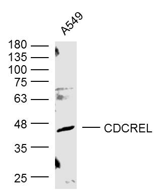 Human A549 lysates probed with CDCREL Polyclonal Antibody, Unconjugated (bs-6905R) at 1:300 dilution and 4˚C overnight incubation. Followed by conjugated secondary antibody incubation at 1:10000 for 60 min at 37˚C.