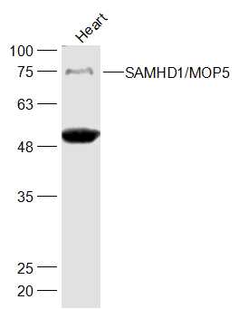 Mouse Heart lysates probed with SAMHD1'MOP5 Polyclonal Antibody, Unconjugated (bs-8060R) at 1:500 dilution and 4˚C overnight incubation. Followed by conjugated secondary antibody incubation at 1:10000 for 60 min at 37˚C.