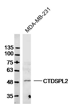 MDA-MB-231 lysates probed with CTDSPL2 Polyclonal Antibody, Unconjugated (bs-8242R) at 1:300 dilution and 4˚C overnight incubation. Followed by conjugated secondary antibody incubation at 1:10000 for 60 min at 37˚C.