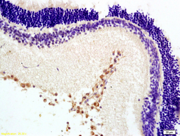 Formalin-fixed and paraffin embedded rat retina labeled with Anti-MTNR1B Polyclonal Antibody, Unconjugated (bs-0963R) at 1:200 followed by conjugation to the secondary antibody and DAB staining.