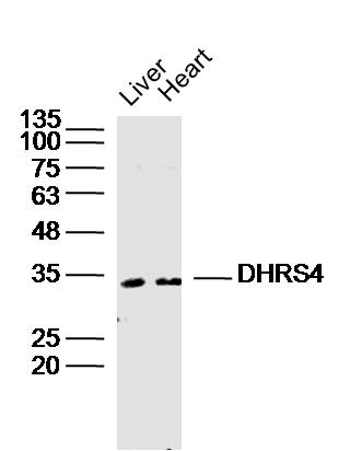 Lane 1: Mouse Liver lysates; Lane 2: Mouse Heart lysates probed with DHRS4 Polyclonal Antibody, Unconjugated (bs-8264R) at 1:300 dilution and 4˚C overnight incubation. Followed by conjugated secondary antibody incubation at 1:10000 for 60 min at 37˚C.