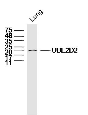 Mouse lung lysates probed with UBE2D2 Polyclonal Antibody, Unconjugated (bs-8348R) at 1:300 dilution and 4˚C overnight incubation. Followed by conjugated secondary antibody incubation at 1:10000 for 60 min at 37˚C. Mouse lung lysates probed with UBE2D2 Polyclonal Antibody, Unconjugated (bs-8348R) at 1:300 dilution and 4˚C overnight incubation. Followed by conjugated secondary antibody incubation at 1:10000 for 60 min at 37˚C.