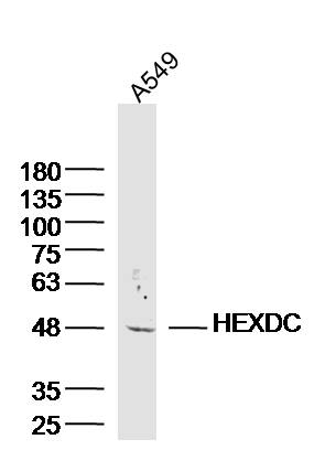 A549 lysates probed with HEXDC Polyclonal Antibody, Unconjugated (bs-8418R) at 1:300 dilution and 4˚C overnight incubation. Followed by conjugated secondary antibody incubation at 1:10000 for 60 min at 37˚C.